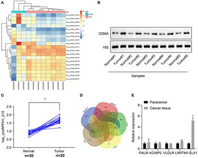 A Novel Circular RNA hsa_circRPPH1_015 Exerts an Oncogenic Role in Breast Cancer by Impairing miRNA-326-Mediated ELK1 Inhibition